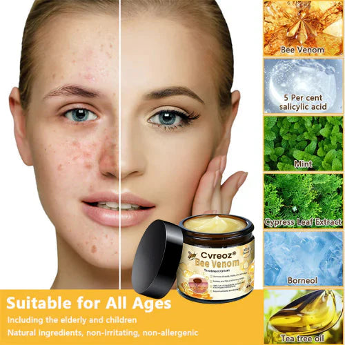 ✅2024 Google Trusted Store - Hypethetic Pharmacy| Cvreoz® Bee Venom Skin Treatment Cream