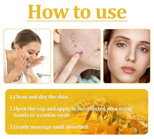 ✅2024 Google Trusted Store - Hypethetic Pharmacy| Cvreoz® Bee Venom Skin Treatment Cream