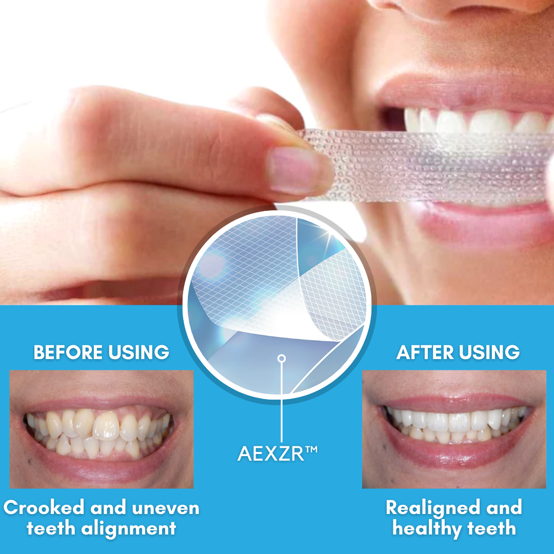 ✅Official Store - Archer Dentist lnc.| AEXZR™ Teeth Aligner Strips