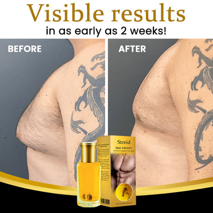 ✅Official Store - Hypethetic Pharmacy| Streid™ Bee Venom Gynecomastia Oil