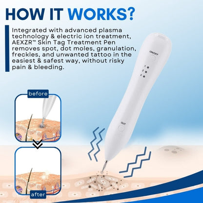 ✅Official Store - Hypethetic Pharmacy| AEXZR™ Skin Tag Treatment Pen