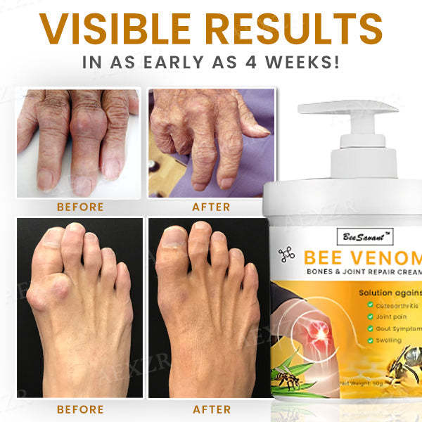 ✅Official Store - Walgreen Pharmacy| BeeSavant™ Bee Venom Bones & Joint Repair Cream