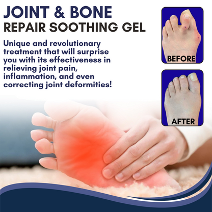 ✅Official Store - Walgreen Pharmacy| AEXZR™ Joint & Bone Repair Gel Roller