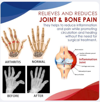 ✅Official Store - Hypethetic Pharmacy| AEXZR™ Joint & Bone Therapy Foam