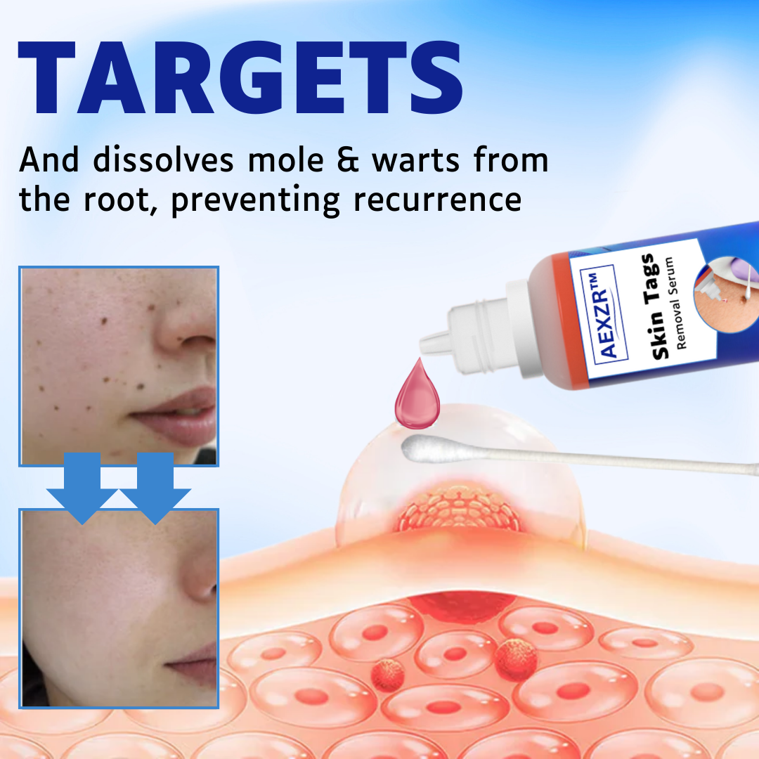 ✅Official Store - Walgreen Pharmacy| AEXZR™ Skin Tags Removal Serum