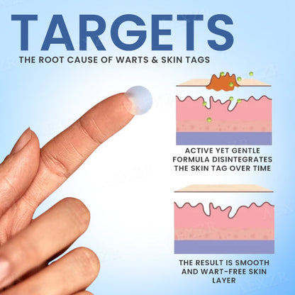 ✅Official Store - Walgreen Pharmacy| Dobshow™ Moles & Warts Removing Skin Tag Patch