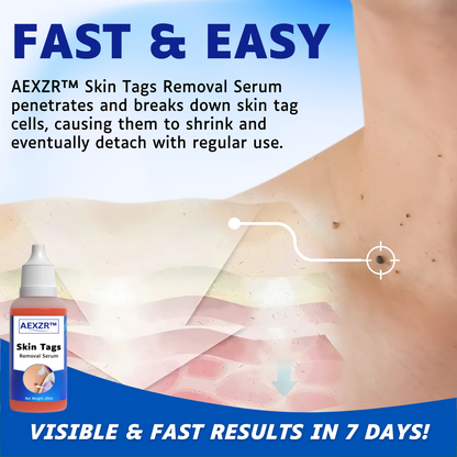 ✅Official Store - Walgreen Pharmacy| AEXZR™ Skin Tags Removal Serum