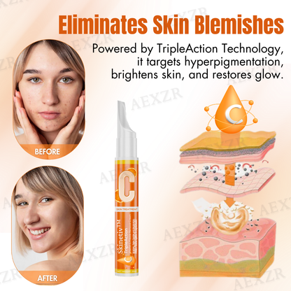 ✅Official Store - Walgreen Pharmacy| Skinetiv™ TripleAction Vitamin C Freckle Removal Cream