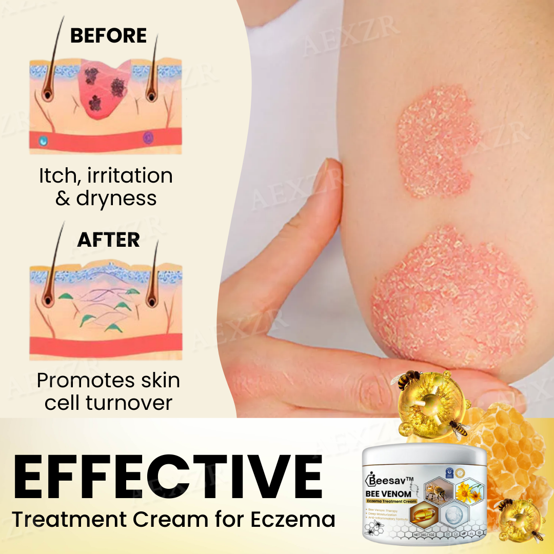 ✅Official Store - Walgreen Pharmacy| Beesav™ Bee Venom Eczema Treatment Cream