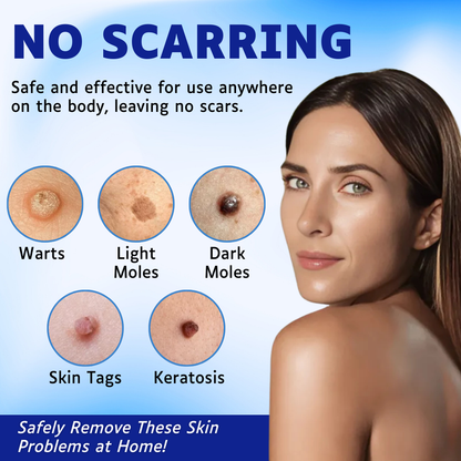 ✅Official Store - Walgreen Pharmacy| AEXZR™ Skin Tags Removal Serum