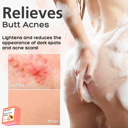 ✅Official Store - Hypethetic Pharmacy| AEXZR™ Butt Care Soap