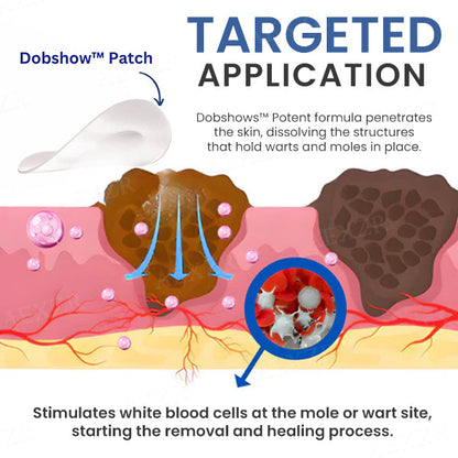 ✅Official Store - Walgreen Pharmacy| Dobshow™ Moles & Warts Removing Skin Tag Patch