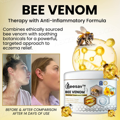 ✅Official Store - Walgreen Pharmacy| Beesav™ Bee Venom Eczema Treatment Cream