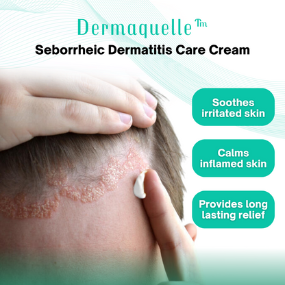 Dermaquelle™ Seborrheic Dermatitis Care Cream