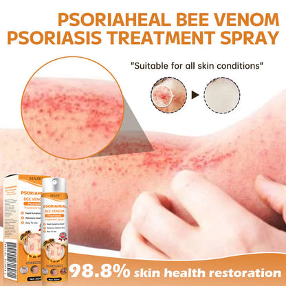 ✅Official Store - Hypethetic Pharmacy| AEXZR™ PsoriaHeal Bee Venom Psoriasis Treatment Spray