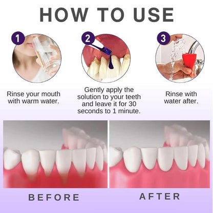 ✅Official Store - Archer Dentist lnc.| AEXZR™ Gum Repairing Gel