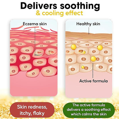 ✅Official Store - Walgreen Pharmacy| AEXZR™ Eczema Cure Cream