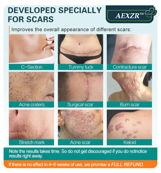 AEXZR™ Advanced Scar Spray