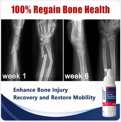 ✅Official Store - Hypethetic Pharmacy| AEXZR™ Joint & Bone Therapy Foam