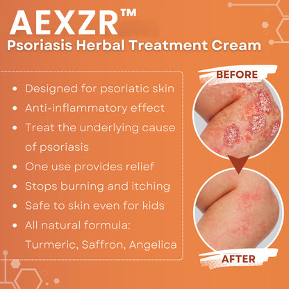 ✅Official Store - Walgreen Pharmacy| AEXZR™ Psoriasis Herbal Treatment Cream