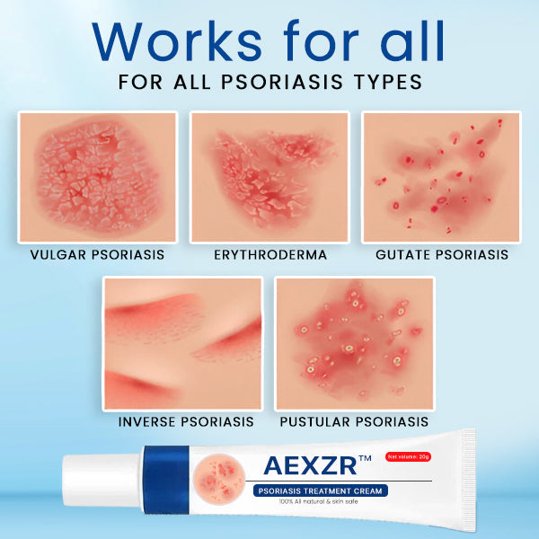 AEXZR™ Psoriasis Treatment Cream